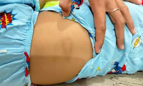 Tạm dừng hoạt động cơ sở giữ trẻ sau vụ bé gái bị chấn thương "vùng kín"