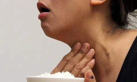 Bị nghẹn họng kéo dài tưởng bệnh dạ dày, người phụ nữ vô tình phát hiện tuyến giáp đã UNG THƯ