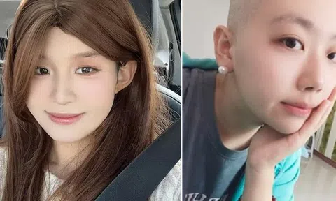 Nữ mukbang Trung Quốc qua đời ở tuổi 25 vì ung thư dạ dày làm dấy lên lo ngại về món ăn triệu người mê