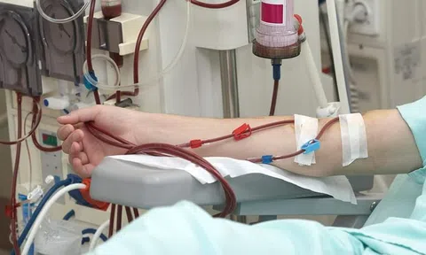 Suy thận tấn công người trẻ: 1 dấu hiệu sớm có thể là có thể là “tín hiệu cầu cứu”