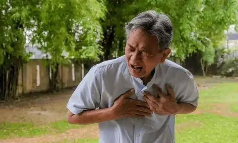 Cụ ông 63 tuổi đột tử vì nhồi máu cơ tim dù kiên trì đi bộ suốt 5 năm: Bác sĩ cảnh báo 3 thói quen sai lầm khi tập thể dục buổi sáng