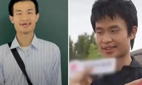 "Thiên tài toán học" Trung Quốc xuất hiện với ngoại hình khác lạ!