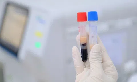 Mê mẩn loại nước này, nhiều người Việt nhận hậu quả nghiêm trọng, máu trắng đục như sữa
