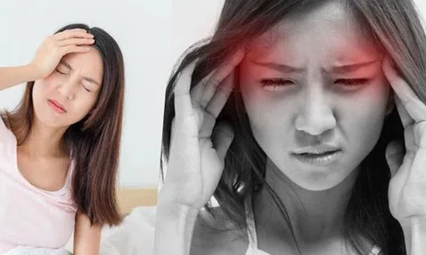 Kiểu đau đầu có thể gây thương tật, mất sức lao động và đột quỵ ở cả người trẻ: 5 triệu chứng không thể bỏ qua