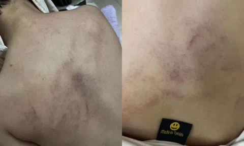 Nóng: Bé gái 4 tuổi bị cô giáo mầm non công lập ở Hà Nội bạo hành dã man, trích xuất camera phát hiện hành động gây sốc
