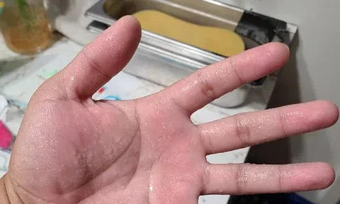 Dù giữa mùa hè, đổ mồ hôi nhiều ở 4 bộ phận này thì... trong người đầy bệnh!