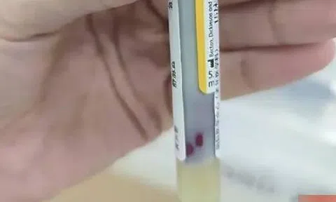 Máu "đặc quánh như sữa chua" vì 3 thú vui nhiều người có