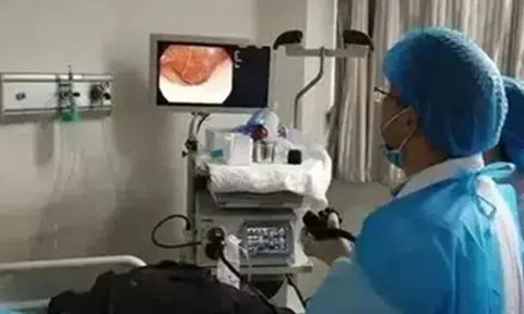 Người đàn ông qua đời vì ung thư đại tràng dù ngủ sớm, dậy sớm, thích đi bộ, bác sĩ lắc đầu: 4 thực phẩm yêu thích của nhiều người là nguyên nhân