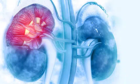 Đây là 5 triệu chứng sớm nhất của suy thận: Nhiều người hối hận vì đã bỏ qua