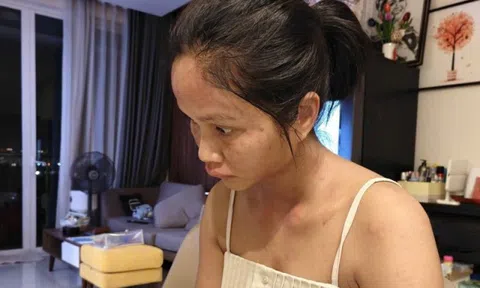 Hoa hậu quốc dân gặp “biến”