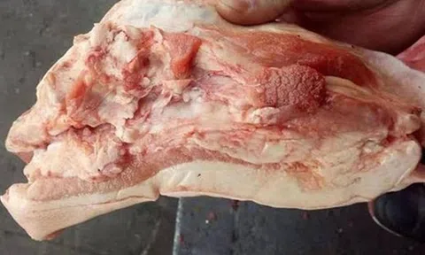 3 phần thịt lợn chứa đầy độc tố và vi khuẩn, rẻ mấy cũng chớ dại mua!