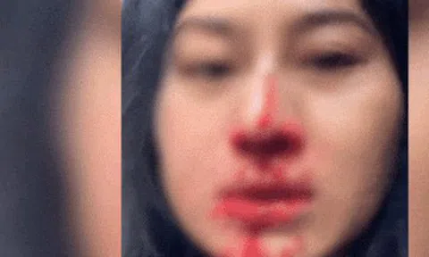 Diễn viên Phi Ngọc Ánh hoảng loạn cầu cứu