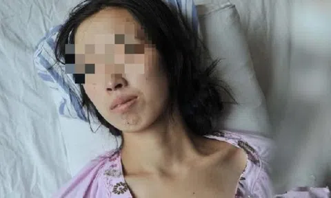 Đi khám vì khó tiêu, người phụ nữ phát hiện ung thư gan: BS hoảng hốt: "Ai lại ăn sáng kiểu này suốt 20 năm?"