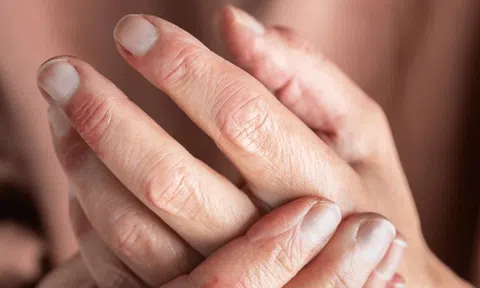 Nhìn tay và chân cũng có thể biết gan bị tổn thương hay không: Đây là 5 dấu hiệu cần lưu ý