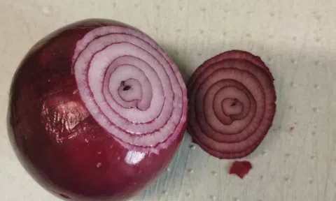 Hành tây có 4 công dụng thần kỳ, ai không biết thì rất thiệt