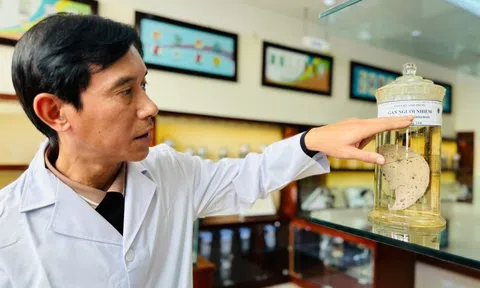 Món "khoái khẩu" của không ít người Việt có thể gây tổn thương gan, thậm chí ung thư