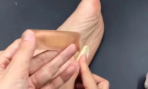 Người phụ nữ 56 tuổi dán tỏi vào lòng bàn chân suốt 6 tháng, kết quả khám sức khỏe khiến bác sĩ "ngã ngửa"