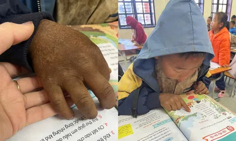 Hình ảnh bàn tay nứt nẻ của cậu bé 8 tuổi vùng cao khiến triệu người nghẹn lại