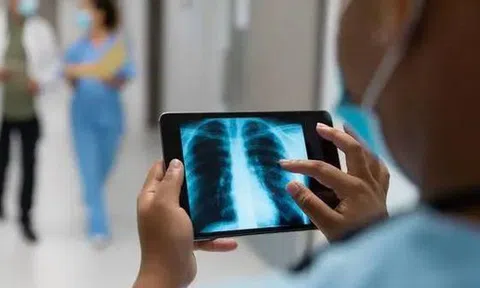 Những người có "phổi sạch" thường có 5 đặc điểm. Nếu bạn có 4 trong số đó, thì xin chúc mừng!