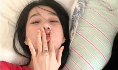 5 điều lưỡi có thể tiết lộ về sức khỏe: Từ ung thư đến nguy cơ đột quỵ cũng có thể hiện ra!