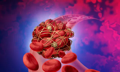 Cục máu đông rất "sợ" 1 loại củ quen mặt trong bếp Việt: Thường xuyên ăn giúp tránh xa đột quỵ, đau tim