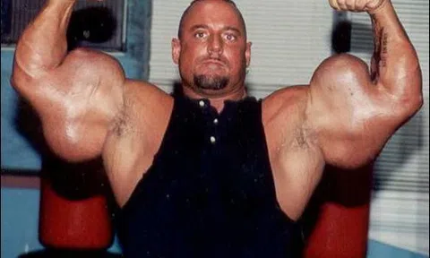 VĐV thể hình sở hữu “cánh tay quái dị” nhất thế giới, sự thật phía sau khiến tất cả ngỡ ngàng