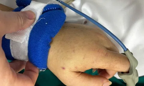 Bệnh viện Bạch Mai phát cảnh báo về 1 căn bệnh nguy hiểm, lây lan nhanh, tỷ lệ tử vong cao