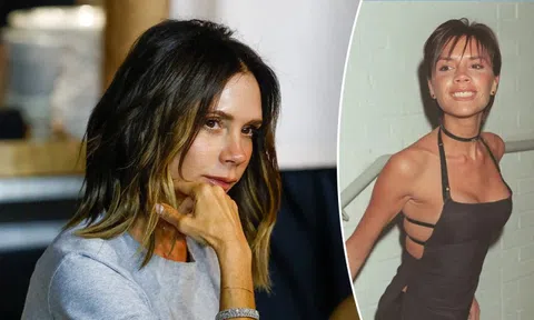 Victoria Beckham đã phải chịu đựng căn bệnh này suốt 25 năm qua
