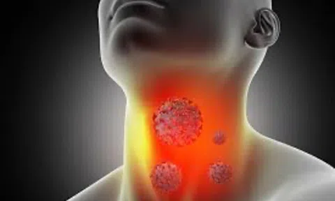 Cổ lên hạch tưởng bị viêm, người đàn ông bất ngờ phát hiện ung thư vòm họng giai đoạn 2: Các dấu hiệu hay bị xem thường