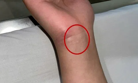 Bệnh viện Trung ương Quân đội 108 phát cảnh báo về 1 căn bệnh nguy hiểm, nhà nào cũng có nguy cơ mầm mống trú ngụ