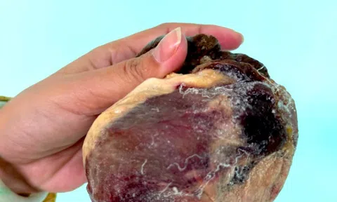 Mổ thịt con bò chỉ ngủ đứng, phát hiện vật thể nghi là ngưu hoàng quý hiếm