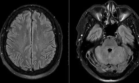 Cảnh báo hệ lụy từ món ăn "lấy may" của nhiều gia đình vào ngày Tết