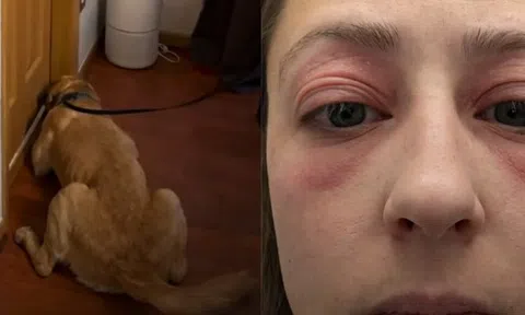 Bỏ 10 tỷ mua nhà, dọn vào ở được vài tháng, người phụ nữ mắc phải căn bệnh lạ khiến cơ thể biến dạng