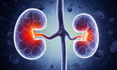 1 thói quen “bức tử” 2 quả thận: Rất nhiều người đang làm mỗi ngày