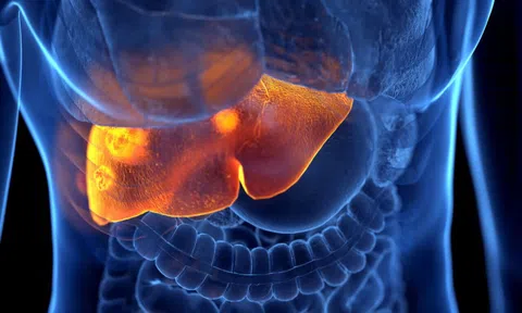 1 dấu hiệu “khó chịu” có thể là tín hiệu cho thấy gan đang suy hỏng nặng: Nếu có cần đi khám ngay