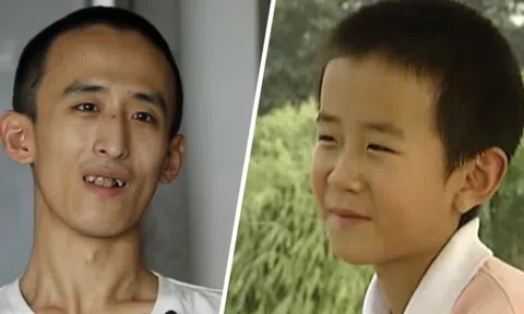 Thần đồng 10 tuổi vào đại học, 16 tuổi lấy bằng Tiến sĩ: Nay thất nghiệp, sống "ăn bám bố mẹ"