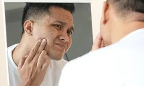 Triệu chứng ban đầu của bệnh tiểu đường có thể xuất hiện trên mặt: Thấy 7 dấu hiệu này, hãy đi khám ngay