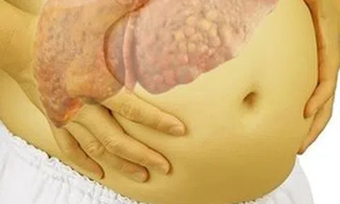 Nhiều người Việt xơ gan, ung thư gan chỉ vì dùng 1 thứ tưởng "lành tính": Bác sĩ cảnh báo
