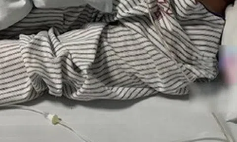 Chàng trai 30 tuổi mắt phải bỗng bị mờ, đi khám bác sĩ kết luận: Hệ miễn dịch đã bị tổn hại hoàn toàn