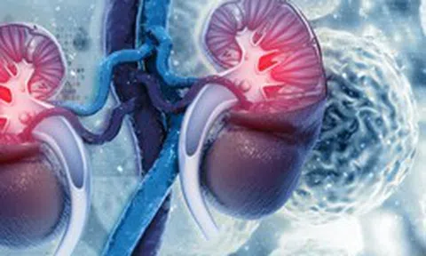 Thận xuống cấp nhanh chóng nếu ăn quá nhiều 9 loại thực phẩm này: Toàn món khoái khẩu của nhiều người