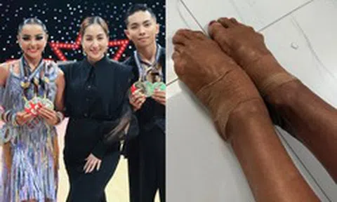 Cận cảnh đôi chân rớm máu, băng bó chằng chịt của kiện tướng Thu Hương khi cùng Phan Hiển giành 3 HCV Đông Nam Á