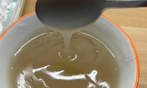 Thiếu nữ 16 tuổi qua đời vì suy thận, người mẹ tiết lộ bí mật liên quan đến điều gần như cô gái nào cũng "ám ảnh"