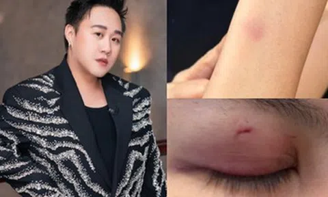 5 vụ sao Việt đánh người: Người thừa nhận say rượu, kẻ bị tát giữa phim trường