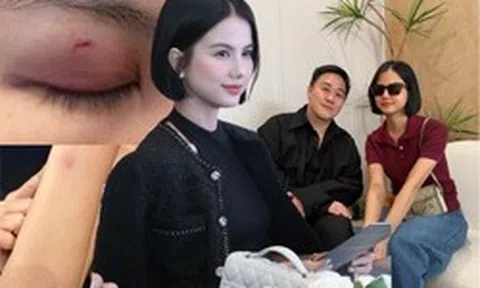 Động thái mới của nữ bác sĩ sau khi Trung Quân idol gặp mặt xin lỗi