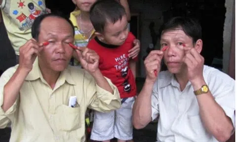 "Kỳ nhân dị sĩ" ăn ớt như rau, chà ớt vào mắt vẫn bình thản, bí ẩn phía sau gây sốc