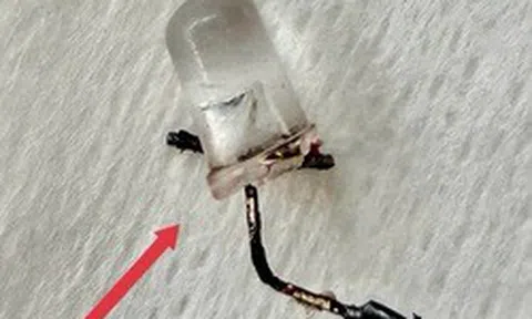 Bác sĩ thót tim gắp đèn LED nằm trong phế quản bé 9 tháng tuổi