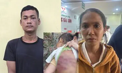 Bắt khẩn cấp đôi nhân tình hành hạ dã man bé trai 2 tuổi gây phẫn nộ dư luận ở TP.HCM
