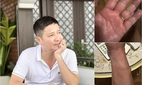 NSƯT Chí Trung mắc bệnh lạ, mất ngủ triền miên