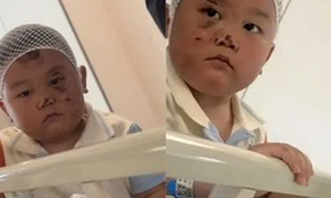 Bé trai 3 tuổi túc trực chăm mẹ sau tai nạn nghiêm trọng: Mặc dù chính bé bị nhiều vết thương đau đớn nhưng vẫn theo sát mẹ không rời