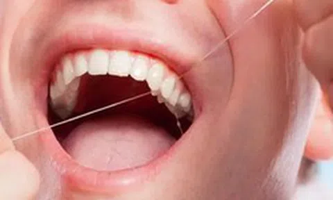 Lời khuyên cho những người sử dụng chỉ nha khoa hàng ngày